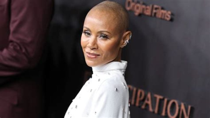 Alopecia Before & After Photos – Hollywood Life
