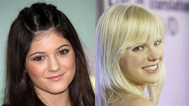 Anna Faris, Kylie Jenner & More — Before & After Pics – Hollywood Life