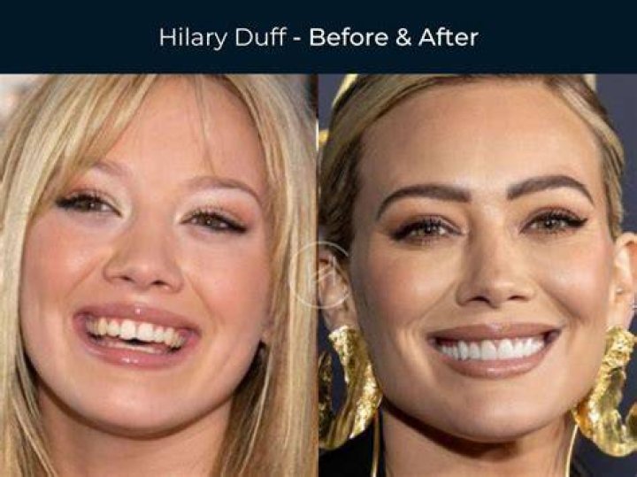 Before and After – Hollywood Life