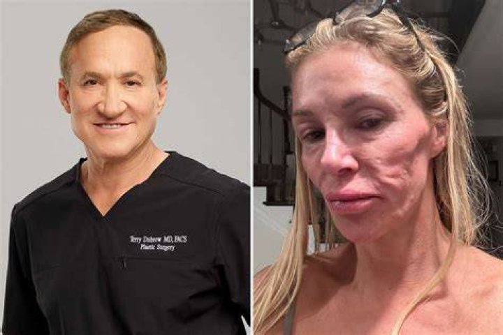 ‘Botched’s’ Terry Dubrow Reveals Kardashian Backside Patients Ask For Most