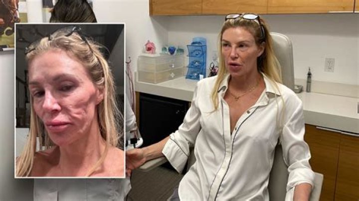 Brandi Glanville ‘Willing To A Take Lie Detector Test’ After Denise Richards Denies Affair