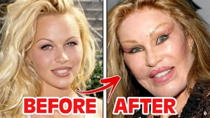 Celebrities Who Regret Getting Plastic Surgery – Hollywood Life
