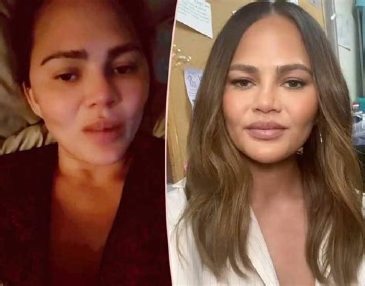 Chrissy Teigen Claps Back At Haters Accusing Her Of Getting Work Done: ‘You Guys Are Somethin’