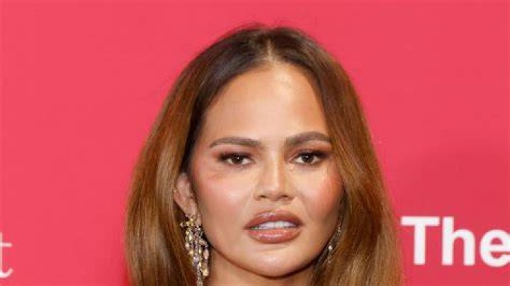 Chrissy Teigen’s Son Miles Has Flat Head Syndrome — Doctor Explains – Hollywood Life