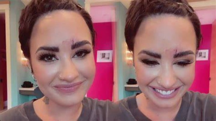 Demi Lovato Suffers Nasty Facial Injury & Reveals They Needs Stitches After Fall: Watch