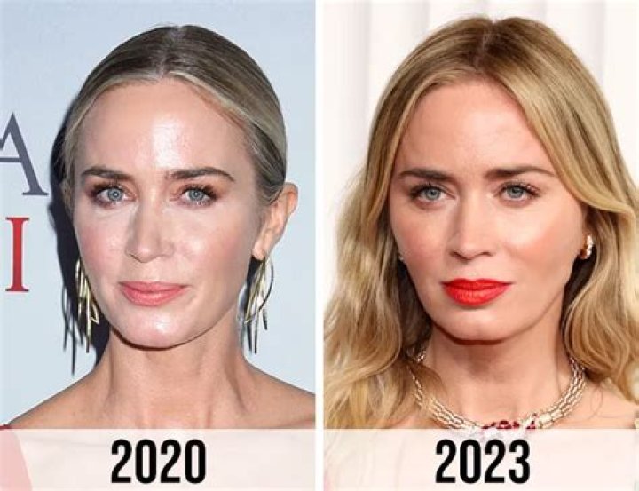 Did ‘Bachelor’ Star Raven Get A Nose Job? Experts Weigh In On Plastic Surgery Rumor