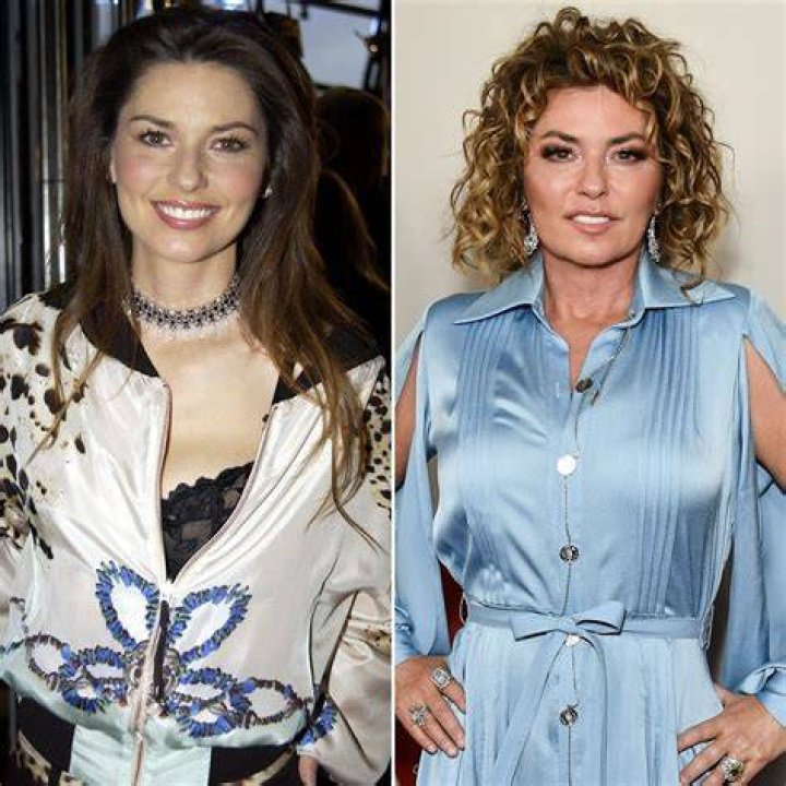 Did Shania Twain Get Fillers & Breast Implants Before ‘DWTS’ Appearance? – Hollywood Life