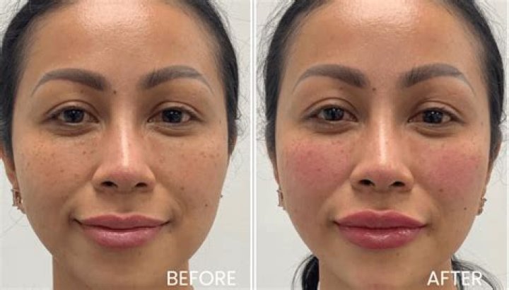Farrah Abraham Reveals She’s Had Her Lip Fillers Removed Just Like Kylie Jenner — Before & After Pics