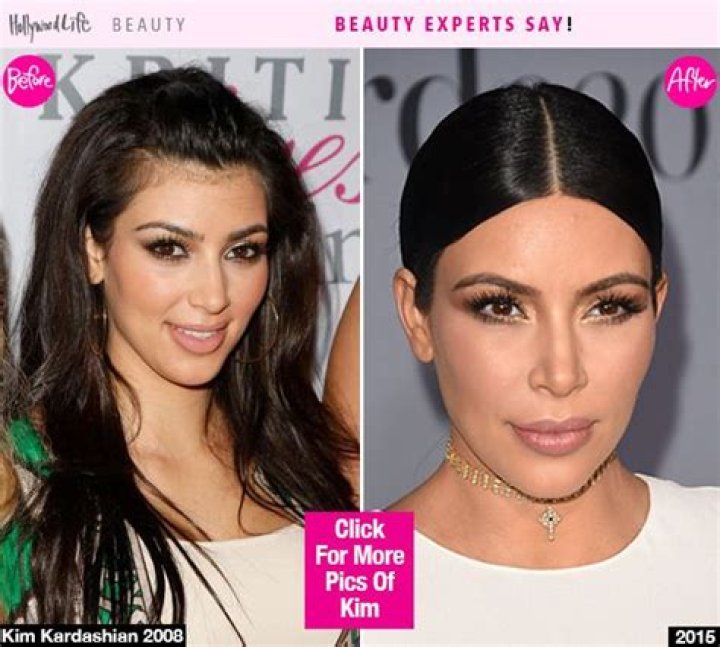Get Rid Of Your Unwanted Hair With A New Laser Like Kim Kardashian