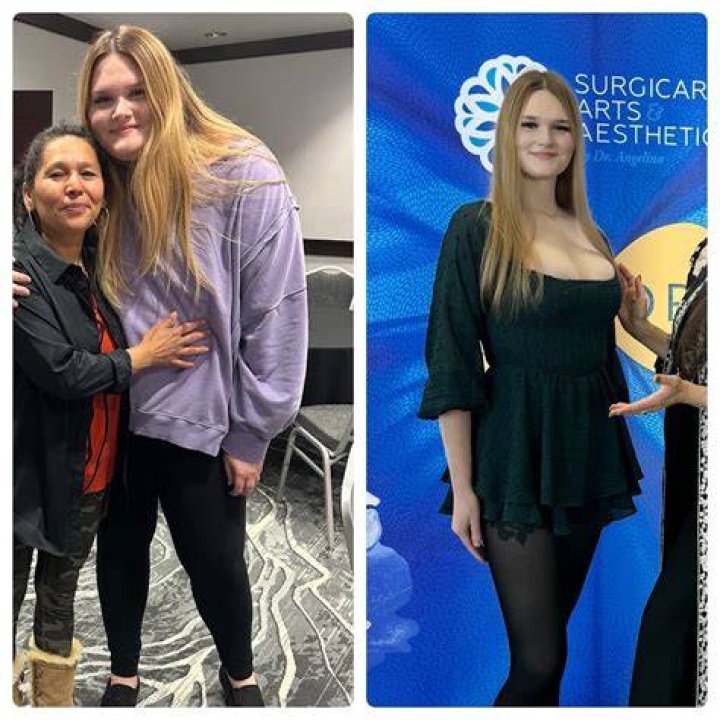 GG Gharachedaghi Reveals 28 Lb. Weight Loss From Ozempic: ‘More’ Than I ‘Anticipated’