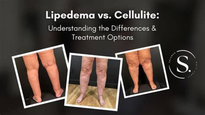 Hey Jennifer Lopez! Get These Four Products to Help the Appearance of Cellulite! – Hollywood Life