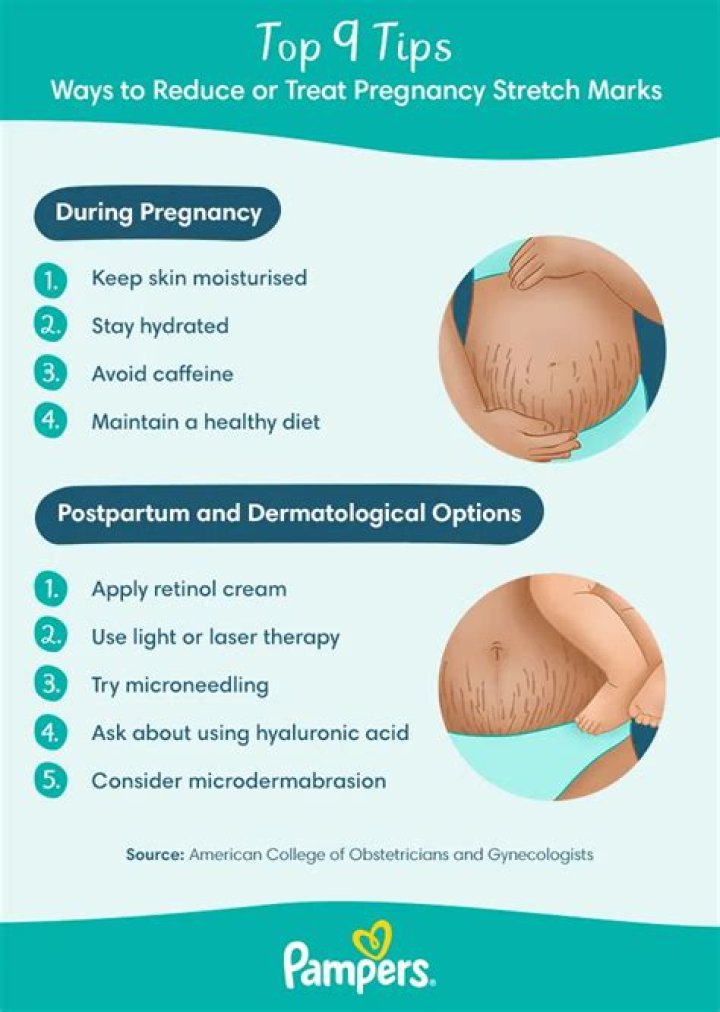 How To Avoid Pregnancy Stretch Marks – Hollywood Life