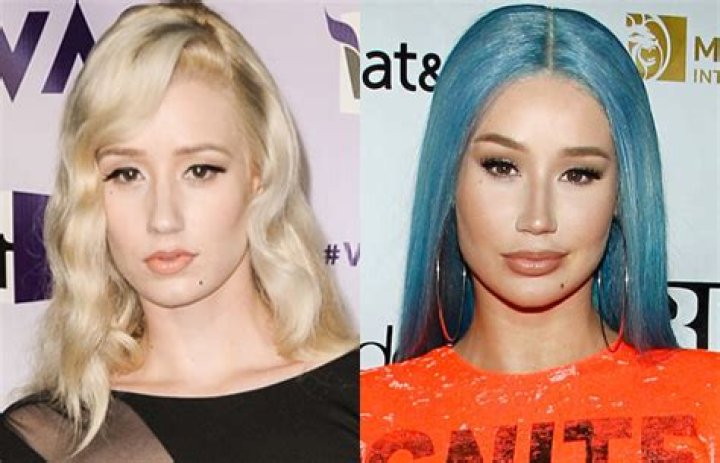 Iggy Azalea’s Plastic Surgery Noticeable In Artwork For New Single – Hollywood Life