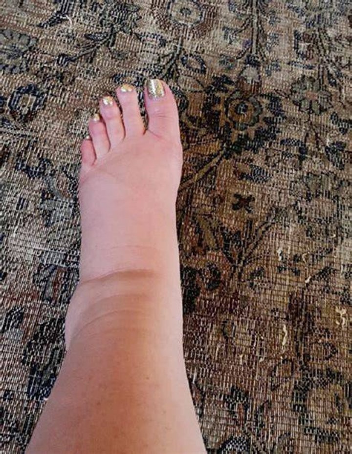 Jessica Simpson’s Preeclampsia Risk After Swollen Foot Pic – Hollywood Life