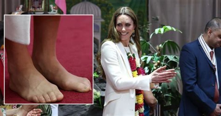 Kate Middleton’s Feet In India — Goes Barefoot & Reveals Tortured Feet – Hollywood Life