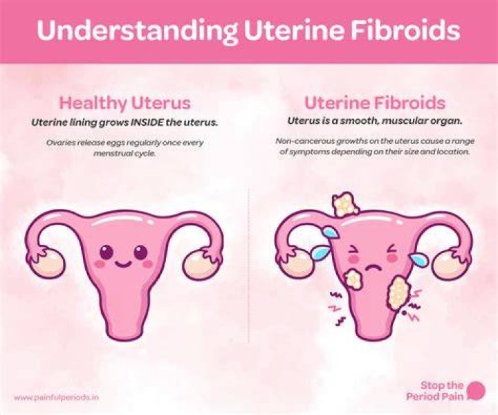 Kelly McCreary Urges Women Not To Ignore Fibroids After Revealing Painful Experience