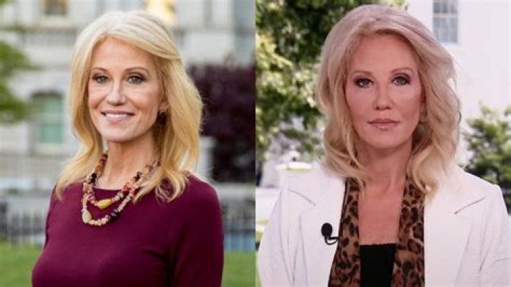 Kellyanne Conway’s Face Looks Different & Sparks Plastic Surgery Rumor – Hollywood Life
