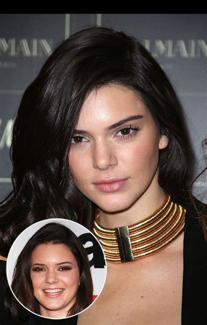 Kendall Jenner Reveals: My Acne Was So Bad I Couldn’t Look People In The Eye
