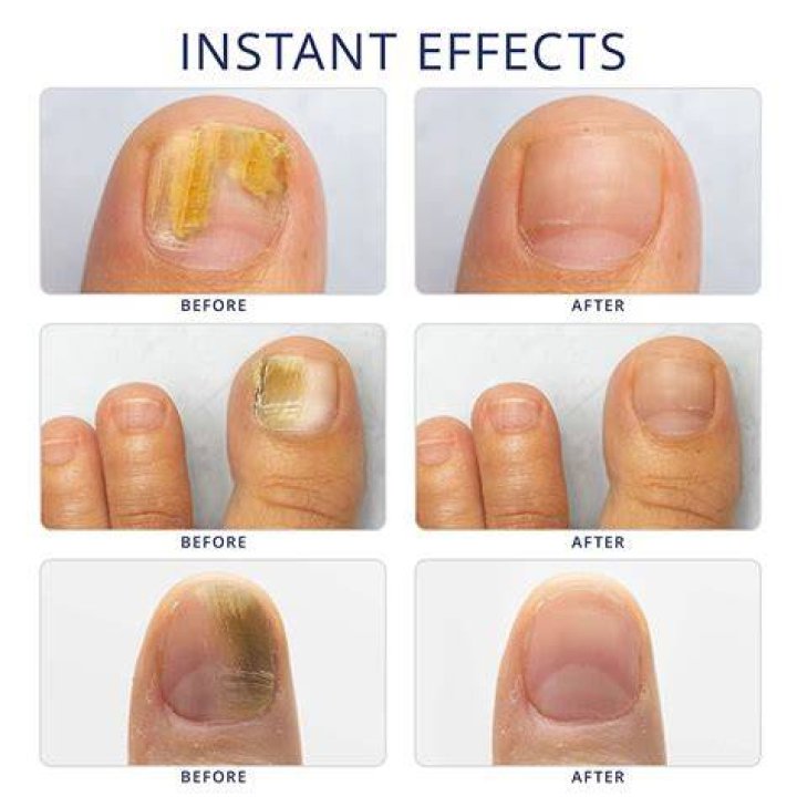 Keratin-Infused Nail Treatment Will Revive Damaged Nails – Hollywood Life