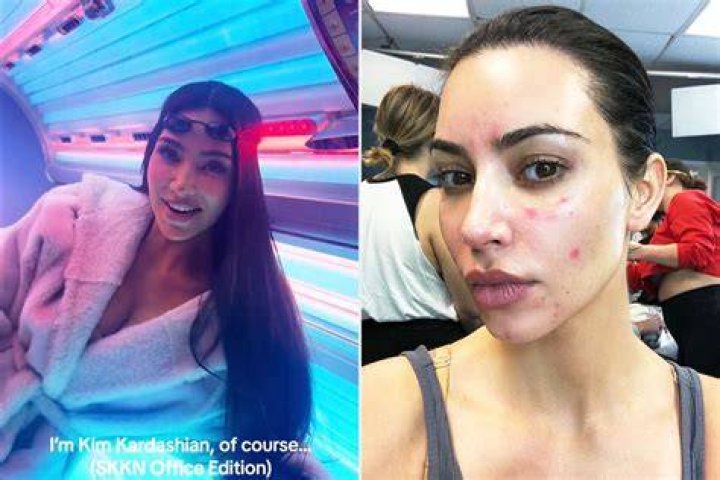 Kim Kardashian Admits Using a Tanning Bed ‘Really Helps’ With Her Psoriasis Amid Controversy