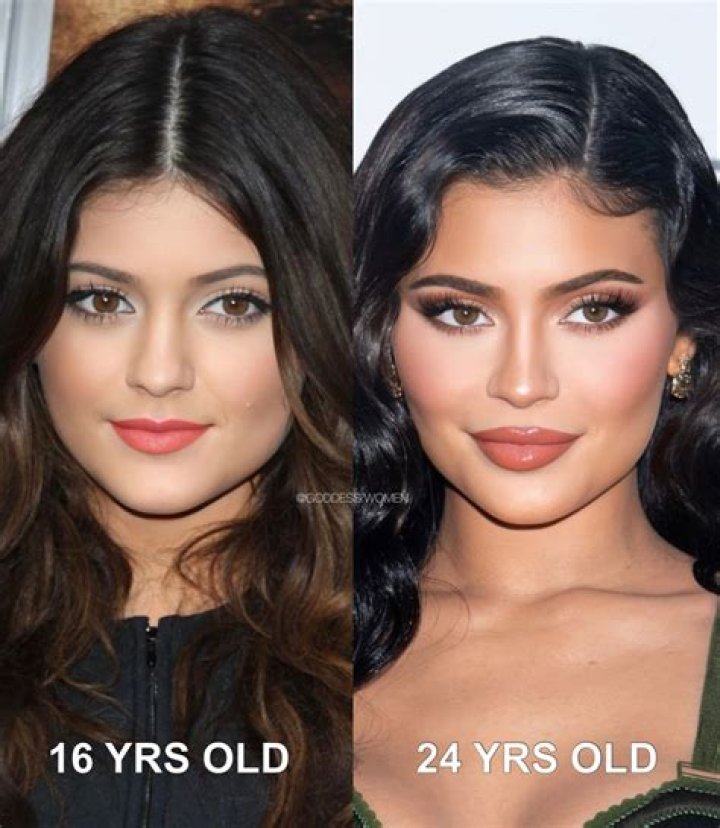 Kylie Jenner Looks Like Jessica Rabbit In New ‘Bronde’ Hair Makeover Pics: Before & After Photos