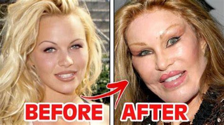 Linda Evangelista, 56, Seen Bare-Faced For 1st Time Since Revealing Botched Cosmetic Procedure