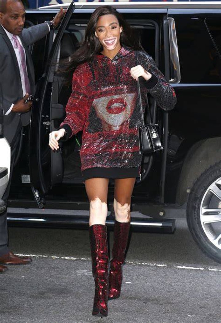 Michelle Obama, Taylor Swift, Winnie Harlow & 4 More Wearing Sparkly Sequin Boots