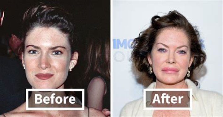Model Linda Evangelista Was ‘Disfigured’ After Cosmetic Procedure – Hollywood Life