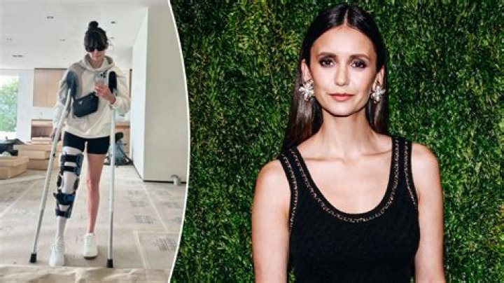 Nina Dobrev Reveals She Was Hospitalized Due To Her Intense Allergies – Hollywood Life