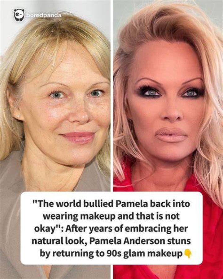 Pamela Anderson Looks Super Young — Expert Weighs In On If She Got Plastic Surgery