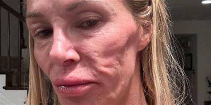 Photo Of Her Face After Brutal Fall – Hollywood Life