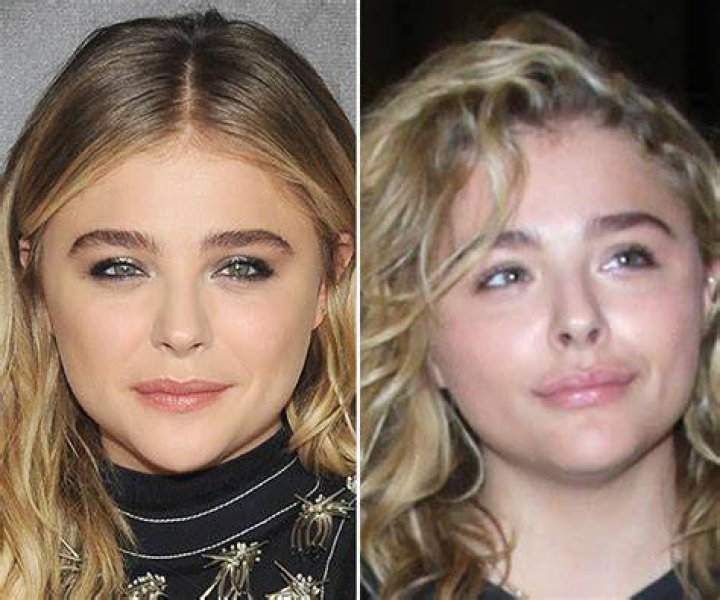 [PICS] Chloe Moretz’s Lip Injections — Before & After Pics Of Lips – Hollywood Life