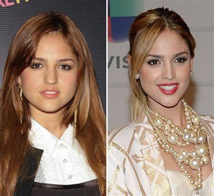 [PICS] Eiza Gonzalez’s Plastic Surgery — She’s Had More Than Nose Job – Hollywood Life