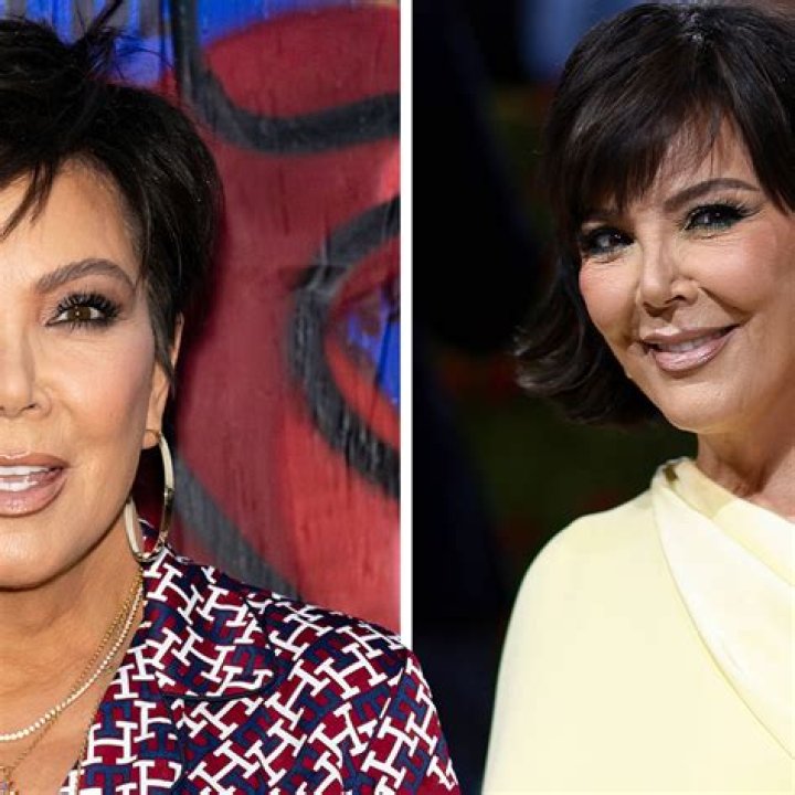 [PICS] Kris Jenner Plastic Surgery — Did Kris Get Fillers? – Hollywood Life