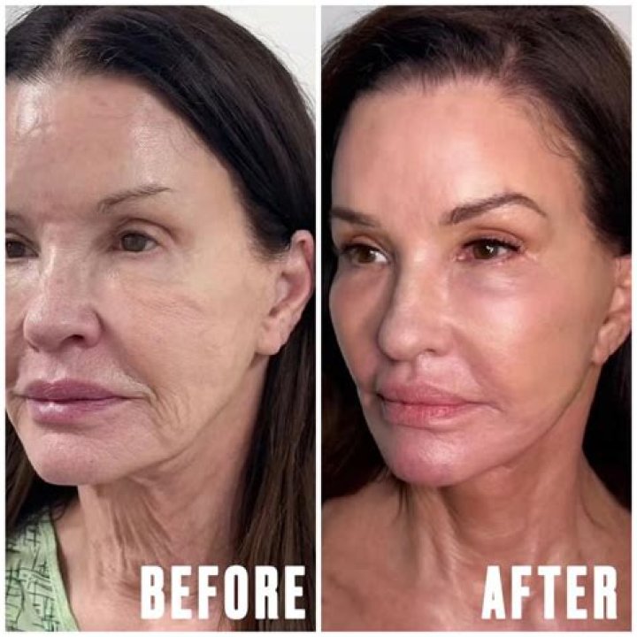 Plastic Surgeon Dr. Harrison H. Lee Helping Her Recover – Hollywood Life