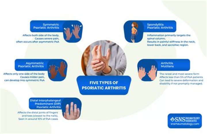 Psoriatic Arthritis: 5 Things To Know About Kim Kardashian’s Illness