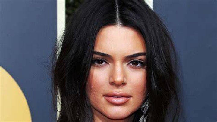 Reveals Acne Again After Being Shamed – Hollywood Life