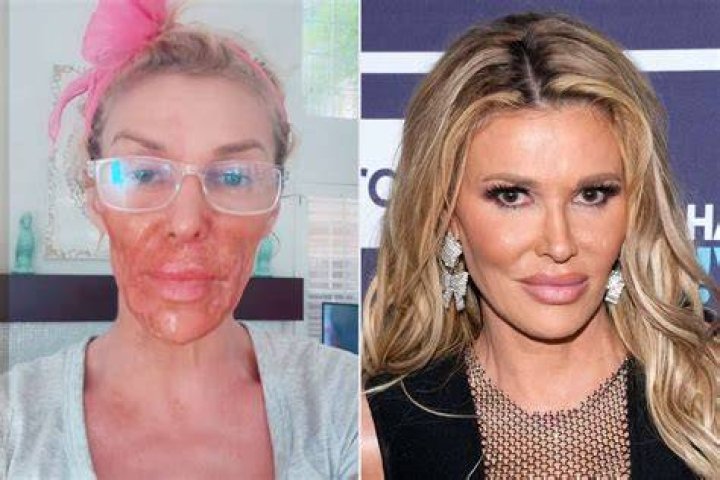 ‘RHOBH’ Cast Fears Denise Richards Will Quit After ‘Fight’ With Brandi Glanville