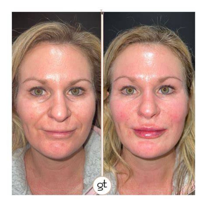 See Full Face Transformation In Trailer – Hollywood Life