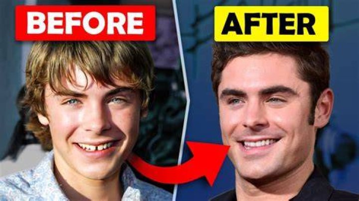 See His Transformation Photos – Hollywood Life