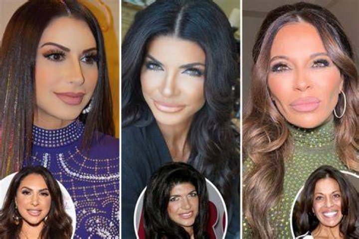See ‘RHONJ’ Star’s Before & After Pics – Hollywood Life