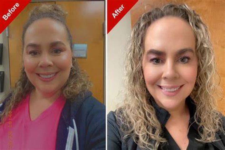 See Stunning Before & After Pics – Hollywood Life