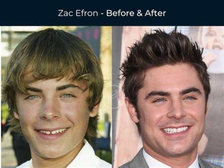 See The Before & After Photos – Hollywood Life