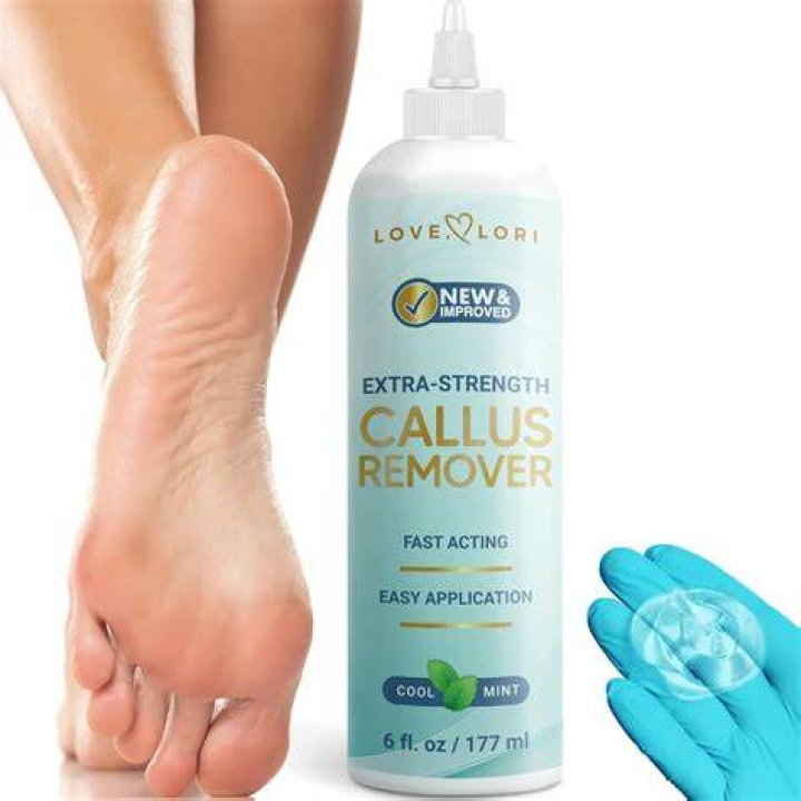 The Top Callus Removers of 2023 – Hollywood Life Review – Hollywood Life
