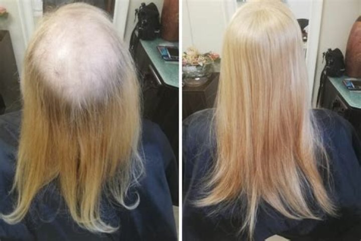 Tiffany Haddish Hair Makeover: She Proudly Shows Off Glamorous Bald Head — Before & After Pics