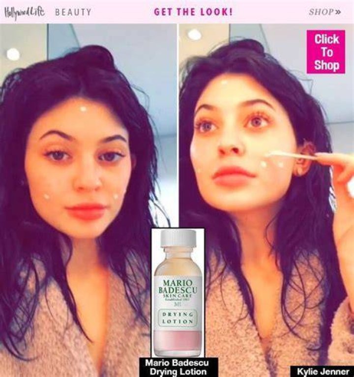 What Kylie Jenner Does When She Gets A Pimple — Buy Her Fave Miracle Product