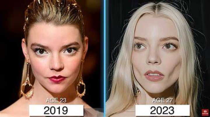 Why I Got Them Removed! – Hollywood Life